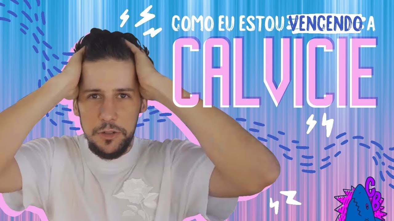 Vencendo a Calvície - Não Compre sem Ler! 30