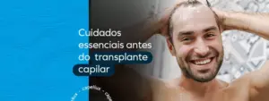 Precauções Importantes Pré-Transplante Capilar – Capellux 16