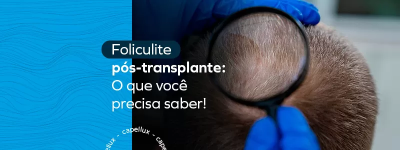 Foliculite após um transplante capilar: Informações essenciais que você deve conhecer! 18