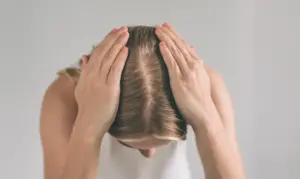 Causas e duração da alopecia difusa: o que você precisa saber | Clínica Bremen 69