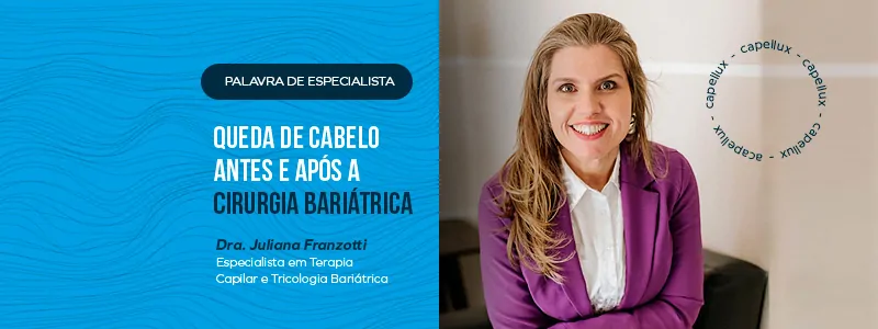 Perda de cabelo antes e depois da cirurgia de perda de peso - Capellux 2